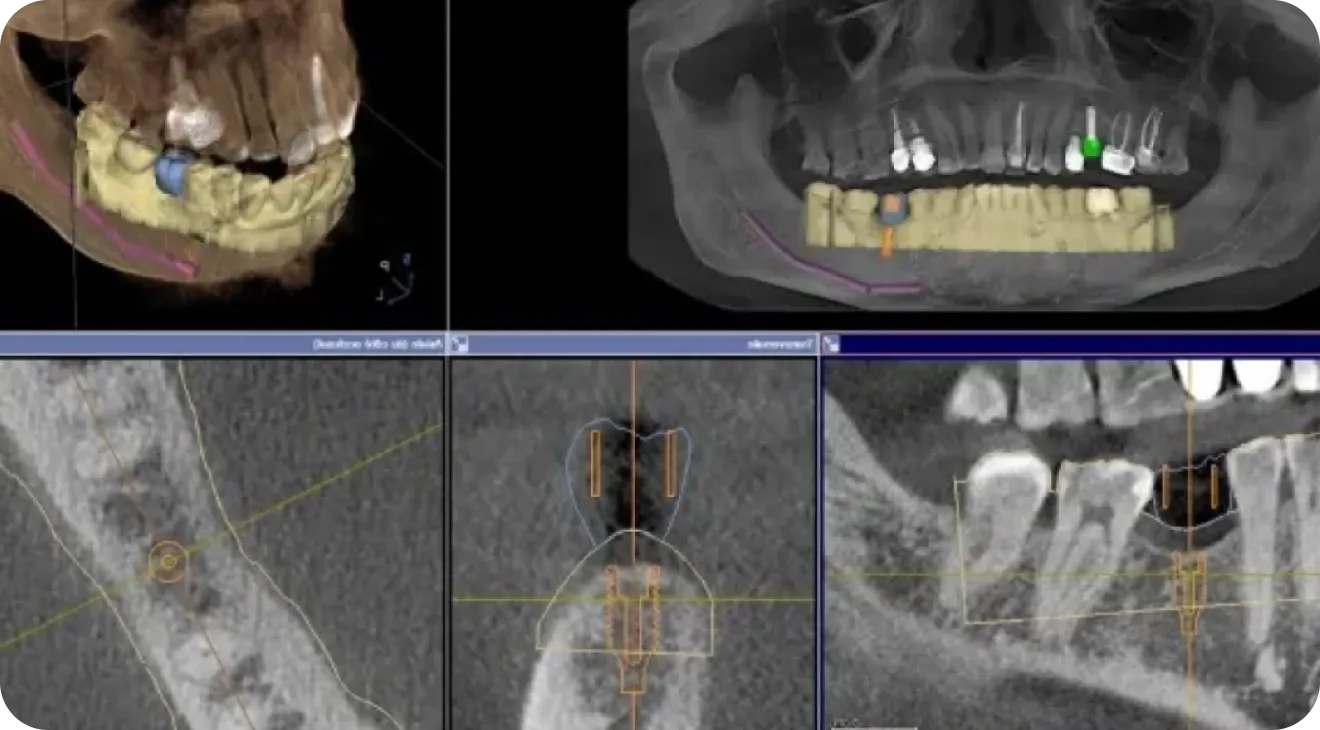 Confort & technologies Dentiste à Toulouse, Dentiste Mathieu Benichou