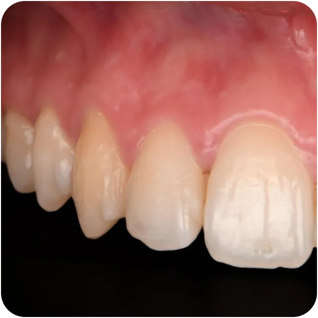 Card_Cas clinique (1)