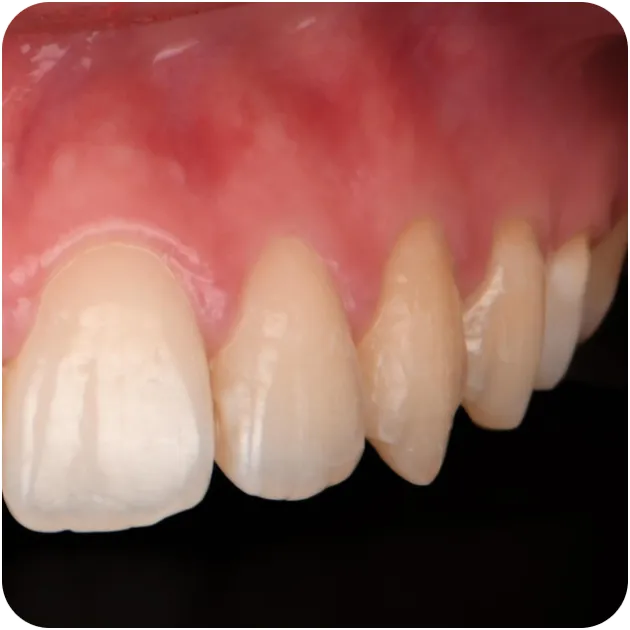 Card_Cas clinique (2)