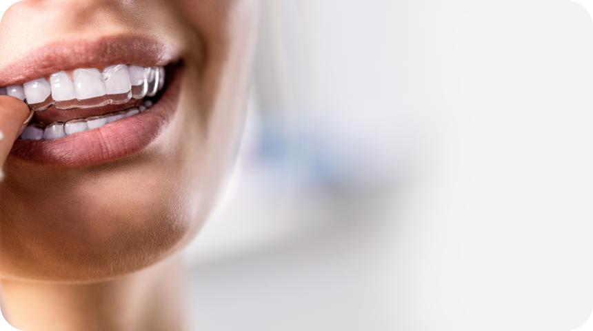 Invisalign et Orthodontie à Toulouse Dentiste à Toulouse, Dentiste Mathieu Benichou