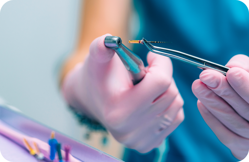 Tout savoir sur l’endodontie Dentiste à Toulouse, Dentiste Mathieu Benichou