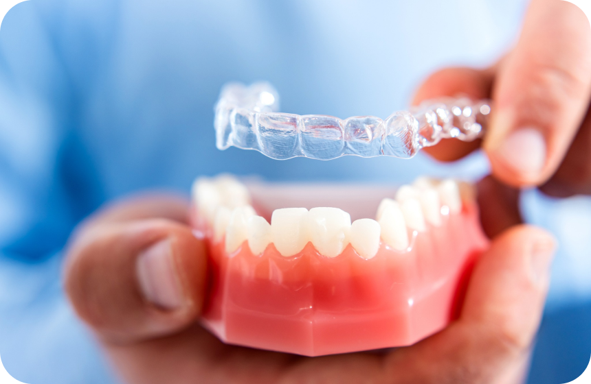 Invisalign avant après : À quel résultat s’attendre ? Dentiste à Toulouse, Dentiste Mathieu Benichou