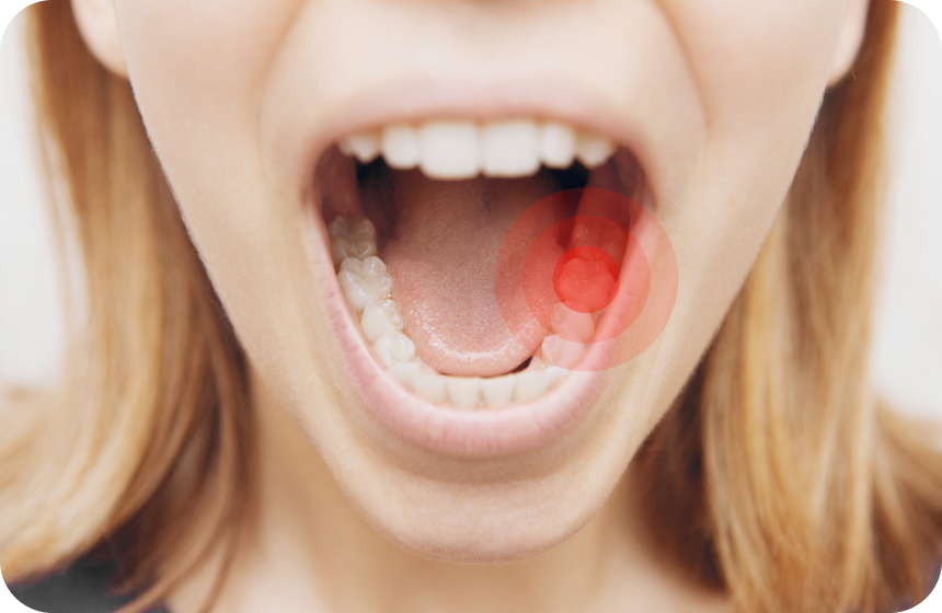 Comment en finir avec la sensibilité dentaire ? Dentiste à Toulouse, Dentiste Mathieu Benichou