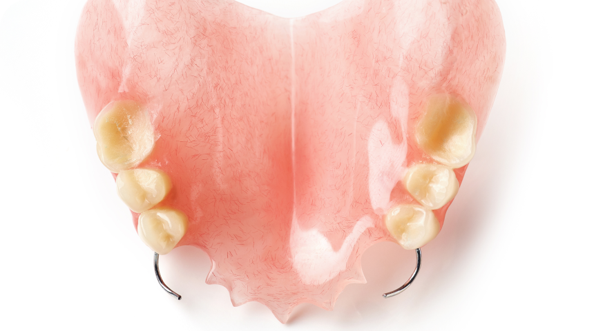 Prothèse dentaire Toulouse Dentiste à Toulouse, Dentiste Mathieu Benichou